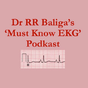 EKG |What type of tachycardia |Dr RR Baliga's "MUST KNOW EKG" Podkast for Physicians