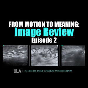 From Motion to Meaning: ULA Image Review, Episode 2