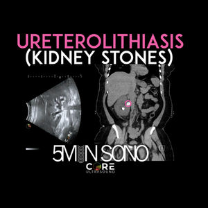 5 Minute Sono - Kidney Stones